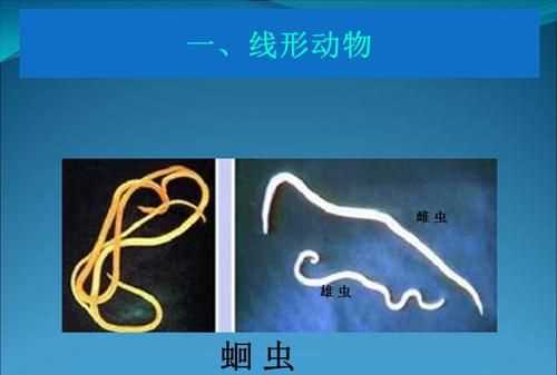 線形動物通常寄生在人的哪個(gè)部位