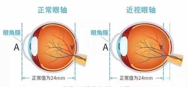 眼鏡可以帶上飛機(jī)嗎，五毫升的隱形眼鏡護(hù)理液可以隨身帶著上飛機(jī)嗎？圖2