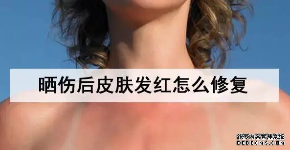 曬傷后皮膚發(fā)紅怎么修復(fù)