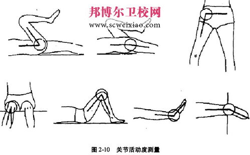 關(guān)節(jié)活動(dòng)度測量方法有哪些