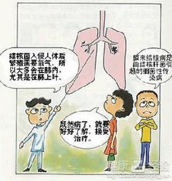 結(jié)核病中醫(yī)治療方法都有哪些呢