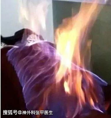 火療的步驟及注意事項(xiàng),火療之后注意事項(xiàng),火療的目的及注意事項(xiàng)