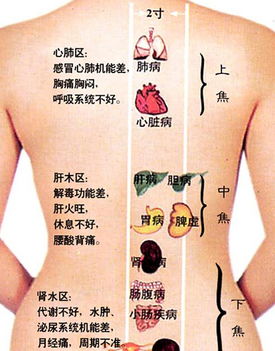 背部刮痧后要注意事項(xiàng)