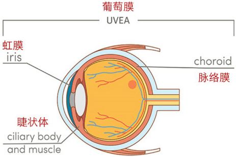 青少得葡萄膜炎應(yīng)該注意事項