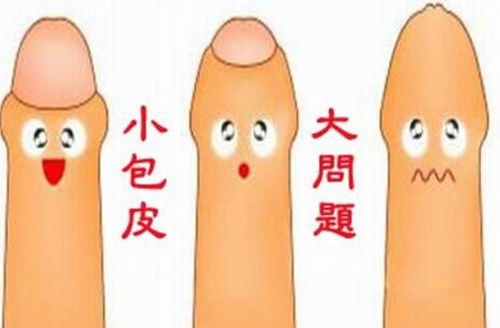 包皮手術(shù)取環(huán)注意事項(xiàng)