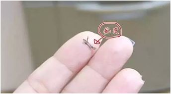 輕氧眉掉痂后注意事項(xiàng)