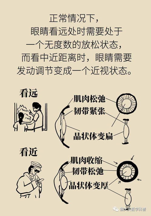 散瞳驗光的危害及注意事項,散瞳驗光的意義及注意事項,散瞳驗光的目的及注意事項