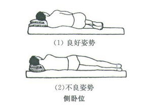 腰椎膨出需要注意什么,腰脊椎膨出注意事項(xiàng),腰椎膨出注意事項(xiàng)