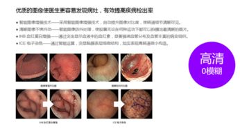 做胃鏡前注意事項(xiàng)m.baidu.com