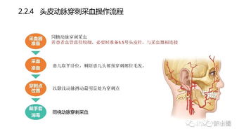 血氣,標(biāo)本,時應(yīng),注意事項
