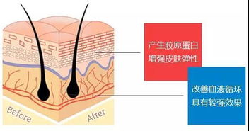 螺旋線,埋入,韓國,蛋白