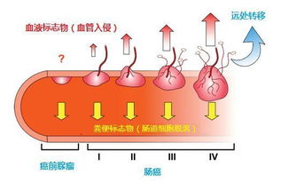 檢查大便之前注意事項(xiàng),嬰兒檢查大便常規(guī)注意事項(xiàng),大便隱血檢查注意事項(xiàng)