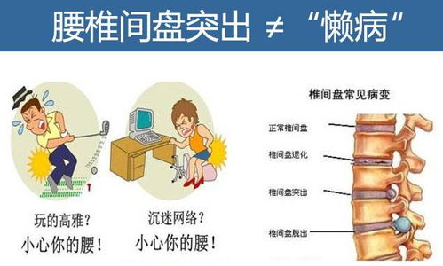 腰椎盤(pán)凸出手術(shù),腰椎盤(pán)凸出治療,腰椎盤(pán)微創(chuàng)手術(shù)后注意事項(xiàng)