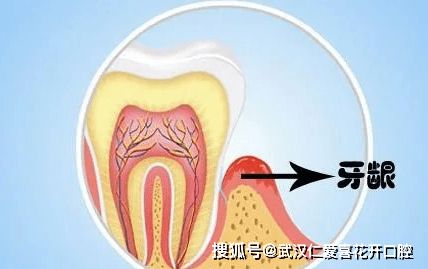 牙槽骨修整術(shù)的注意事項(xiàng),牙及牙槽骨損傷結(jié)扎注意事項(xiàng),牙槽骨釘注意事項(xiàng)