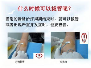 PICC使用注意事項(xiàng)及換藥流程,picc使用注意事項(xiàng)最新指南,picc使用注意事項(xiàng)PPT