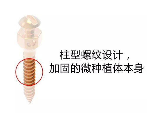支抗釘打后注意事項(xiàng)