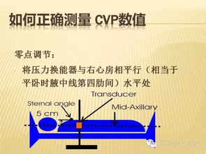 簡(jiǎn)述測(cè)量cvp的注意事項(xiàng),測(cè)量CVP的注意事項(xiàng),CVP注意事項(xiàng)