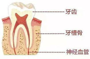 牙槽骨切除術(shù)注意事項(xiàng)