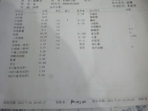 偏高,注意事項(xiàng),飲食,尿素氮