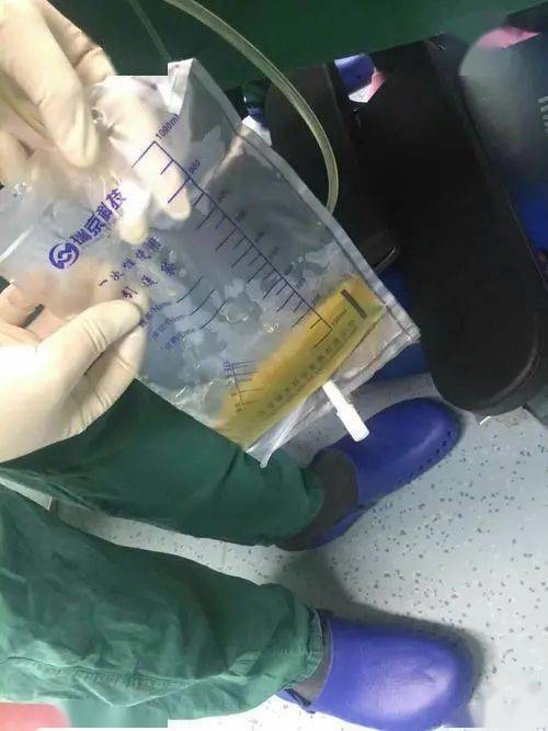 胸膜腔閉式引流的護(hù)理措施有什么,胸膜腔閉式引流的護(hù)理要點(diǎn),關(guān)于胸膜腔閉式引流的護(hù)理,錯(cuò)誤的是()