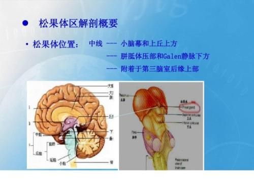 松果體囊腫注意事項(xiàng),兒童松果體鈣化,松果體腫瘤飲食注意事項(xiàng)