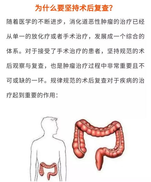 結腸灌洗的方法和注意事項,中藥全結腸灌洗注意事項,結腸esd術后注意事項