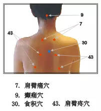 拔罐的禁忌和注意事項(xiàng),拔罐注意事項(xiàng)和禁忌癥,拔罐的操作流程及注意事項(xiàng)