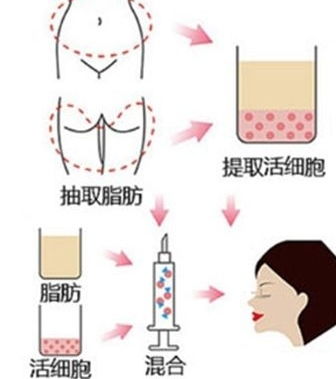 填充,注意事項(xiàng)