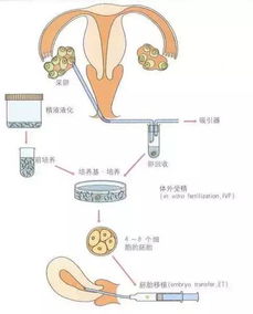 試管前男性注意事項(xiàng)