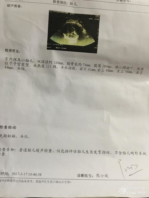 破腹產(chǎn)第一天注意事項(xiàng)