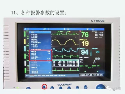 心電監(jiān)護儀使用注意事項
