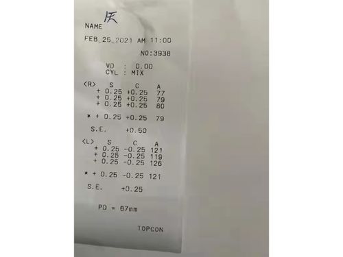 激光打眼術(shù)后注意事項(xiàng)