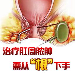 手術(shù)治療,注意事項(xiàng)