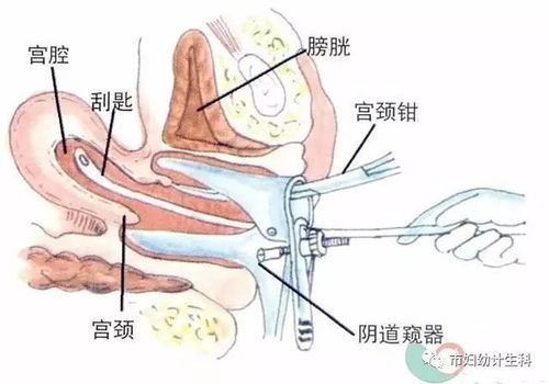 做無痛人流前需要注意什么,做無痛人流手術(shù)前需要注意什么,無痛人流手術(shù)前注意事項(xiàng)有哪些