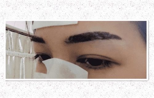 注意事項(xiàng),輕氧眉掉痂后