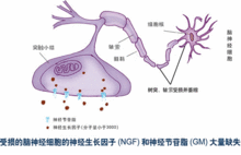 神經(jīng)移植注意事項(xiàng)