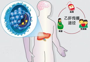 乙肝病毒攜帶者生孩子注意事項