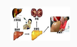 護(hù)理梅毒患者注意事項(xiàng),梅毒患者日常生活注意事項(xiàng),梅毒患者平時(shí)注意事項(xiàng)