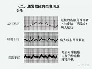 上心電監(jiān)護的注意事項