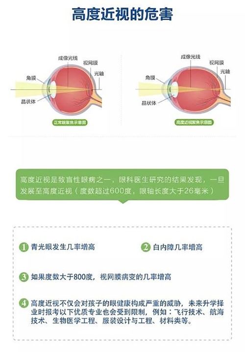高度近視可以做手術嗎,高度近視有必要做手術嗎,高度近視建議做手術嗎