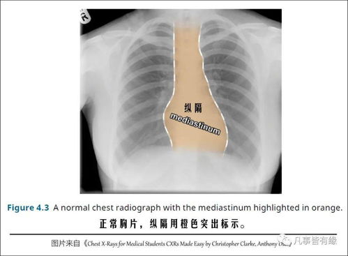 胸外泌尿基礎(chǔ)知識