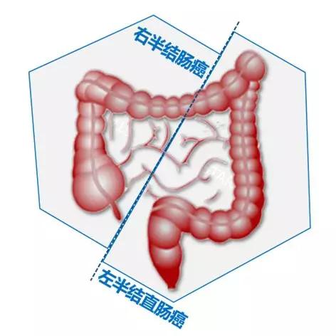 結(jié)直腸癌基礎(chǔ)知識(shí)
